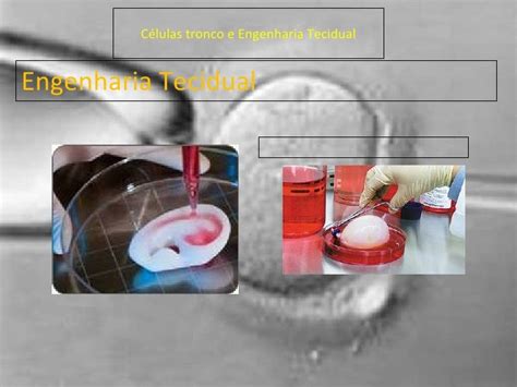  Resorbable Polymers: Os Campeões da Engenharia Tecidual Transformadora?